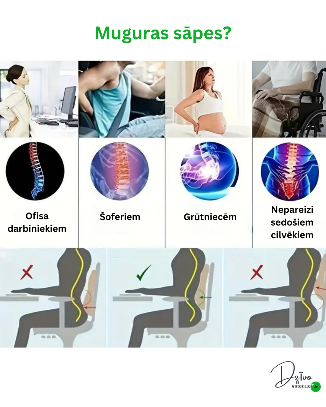 Muguras sāpes Ergonomiskais muguras spilvens